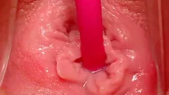 Open wide with a speculum and inscert a toy.