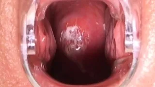 Pissing babe pisses outdoor n gapes hole