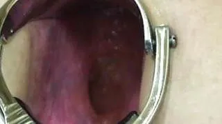 Elmer wife extreme anal speculum play