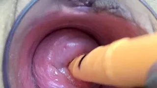 Japanese Milf Cervix Fucking with german real penis dildo