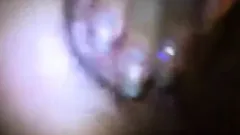 Me Anal Fucking Young Skinny Hairy Teen