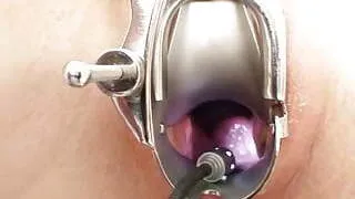 Foxy blond girl Leona vagina gyno checkup