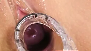 Czech babe Carmen Blue pussy spreader check up