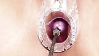 Brunette babe Melissa Ria and dirty gyno doctor