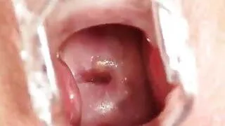 Redhead grandma Zita internal pussy cervix shots