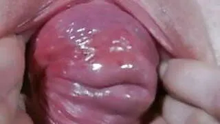 Cervix prolapse & extreme pussy dilation dirtygardengirl